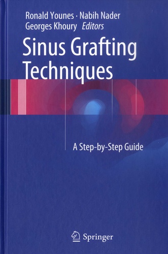 Sinus Grafting Techniques. A Step-by-Step Guide  avec 1 DVD