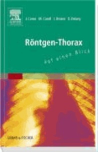 Röntgen-Thorax auf einen Blick.