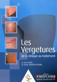 Les Vergetures