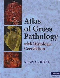 Atlas of Gross Pathology with Histologic Correlation