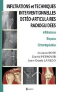 Infiltrations et Techniques Interventionnelles ostéo-articulaires radioguidées