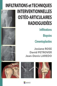 Infiltrations et Techniques Interventionnelles ostéo-articulaires radioguidées