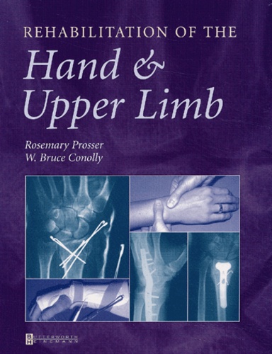 Rosemary Prosser et W-Bruce Conolly - Rehabilitation of the Hand & Upper Limb.