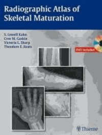 Radiographic Atlas of Skeletal Maturation.pdf