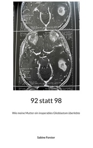 Sabine Forster - 92 statt 98 - Wie meine Mutter ein inoperables Glioblastom überlebte.