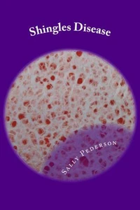Shingles Disease: The Complete Guide