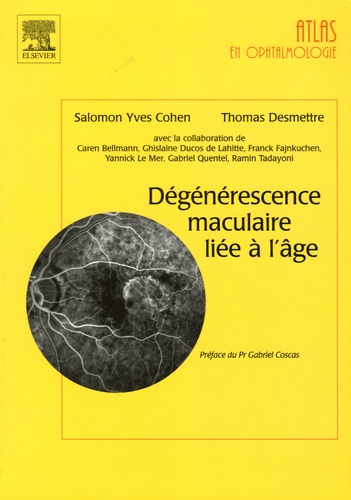 Salomon-Yves Cohen et Thomas Desmettre - Dégénérescence maculaire liée à l'âge.