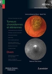 Salomon-Yves Cohen et Sarah Tick - Tumeurs choroïdiennes et rétiniennes / Divers (volume 8 - coffret Rétine) - (volume 8 - coffret Rétine).