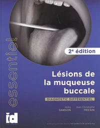 Lésions de la muqueuse buccale