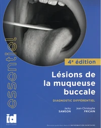 Lésions de la muqueuse buccale