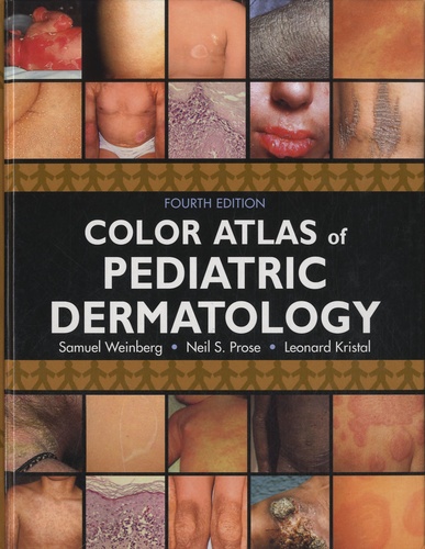 Samuel Weinberg et Neil Prose - Color Atlas of Pediatric Dermatology.
