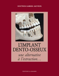 L'implant dento-osseux