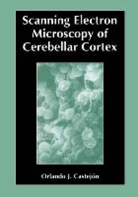 Scanning Electron Microscopy of Cerebellar Cortex.
