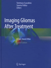 Imaging Gliomas After Treatment