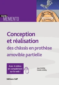 Conception et réalisation des chassis en prothèse amovible partielle