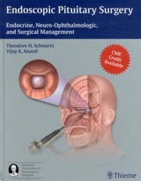 Endoscopic Pituitary Surgery