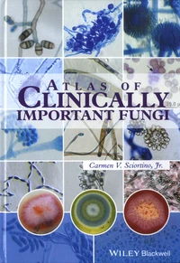 Atlas of Clinically Important Fungi