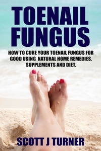  Scott J Turner - Toenail Fungus: How to Cure Your Toenail Fungus for Good using Natural Home Remedies, Supplements and Diet.