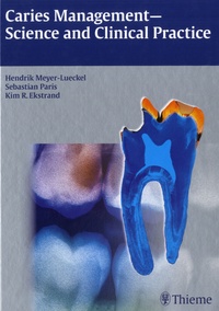 Sebastian Paris et Hendrik Meyer-Lueckel - Caries Management-Science and Clinical Practice.