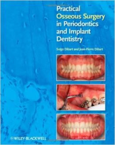 Serge Dibart - Practical Osseous Surgery in Periodontics and Implant Dentistry.