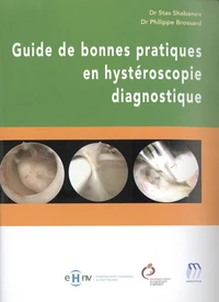 Guide de bonnes pratiques en hystéroscopie diagnostique