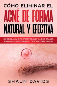 Cómo Eliminar el Acné de Forma Natural y Efectiva: Remedios altamente efectivos para eliminar granos, espinillas, puntos negros y cicatrices para siempre