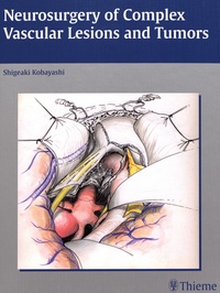 Shigeaki Kobayashi - Neurosurgery of Complex Vascular Lesions and Tumors.