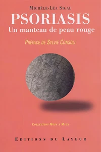 Psoriasis