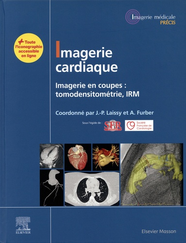 Imagerie cardiaque. Imagerie en coupes : tomodensitométrie, IRM