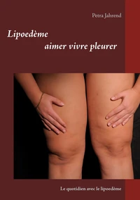 Le quotidien avec le lipoedème