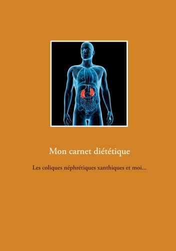 Cédric Menard - Mon carnet diététique : les coliques néphrétiques xanthiques et moi....