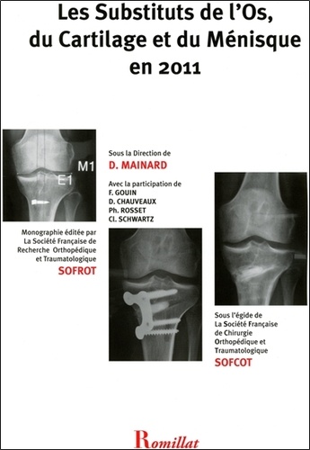  SOFROT - Les substituts de l'os, du cartilage et du ménisque en 2011.