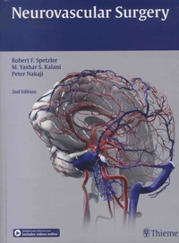 Neurovascular Surgery