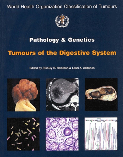 Stanley-R Hamilton et Lauri-A Aaltonen - Pathology and genitics of tumours of the digestive system.