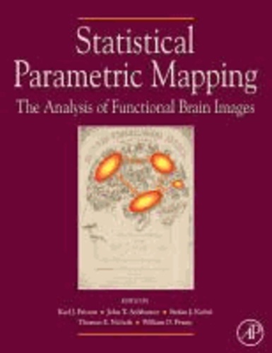 Statistical Parametric Mapping - The Analysis of Functional Brain Images.
