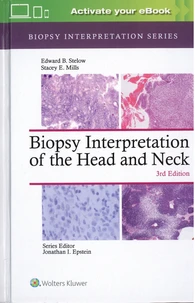 Biopsy Interpretation of the Head and Neck