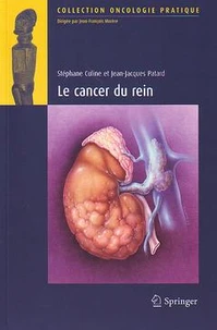 Le cancer du rein