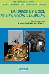 Stéphane Louryan et Marc Lemort - Imagerie de l'oeil et des voies visuelles.