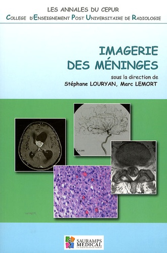 Stéphane Louryan et Marc Lemort - Imagerie des méninges.