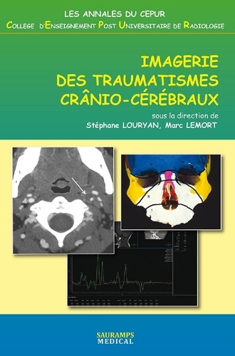 Stéphane Louryan et Marc Lemort - Imagerie des traumatismes crânio-cérébraux.