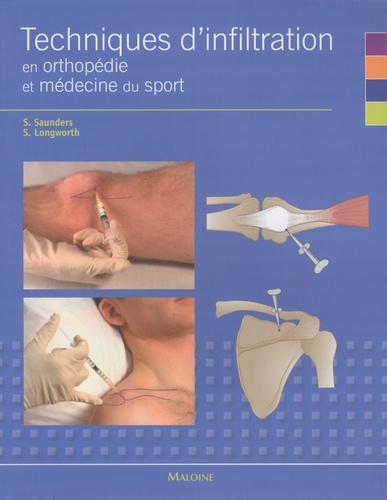 Stephanie Saunders et Steve Longworth - Techniques d'infiltration en orthopédie et médecine du sport - Un manuel pratique pour les médecins.