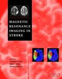 Stephen Davis - Magnetic Resonance Imaging In Stroke.