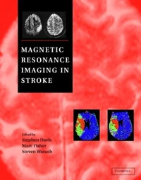 Magnetic Resonance Imaging In Stroke