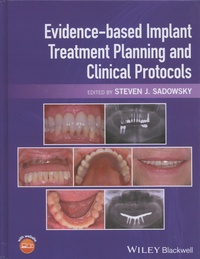 Steven Sadowsky - Evidence-based Implant Treatment Planning and Clinical Protocols.