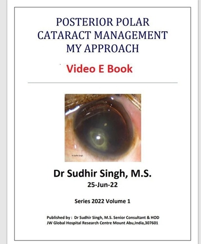  Sudhir Singh - Posterior Polar Cataract Management: My Approach - 2022, #1.