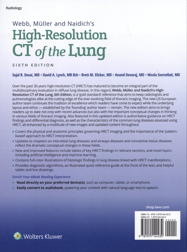 Webb, Müller and Naidich's High-Resolution CT of the Lung 6th edition
