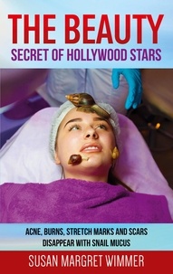 Susan Margret Wimmer - The Beauty - Secret of Hollywood Stars - Acne, Burns, Stretch and Scars Disappear with Snail Mucus.