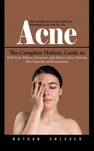 Acne: The Ultimate Acne Cure Guide for Becoming Acne Free for Life (The Complete Holistic Guide to Heal Acne, Balance Hormones, and Achieve Clear, Glowing Skin Naturally and Permanently)