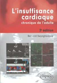L'insuffisance cardiaque chronique de l'adulte