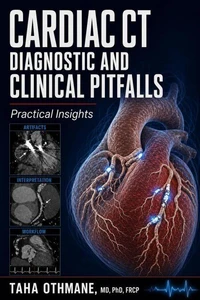 Cardiac CT Diagnostic and Clinical Pitfalls: Practical Insights